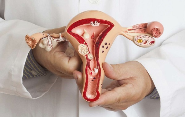 Phụ nữ có triệu chứng rong kinh hoặc ra máu bất thường cần đi khám phụ khoa ngay dù đang hành kinh